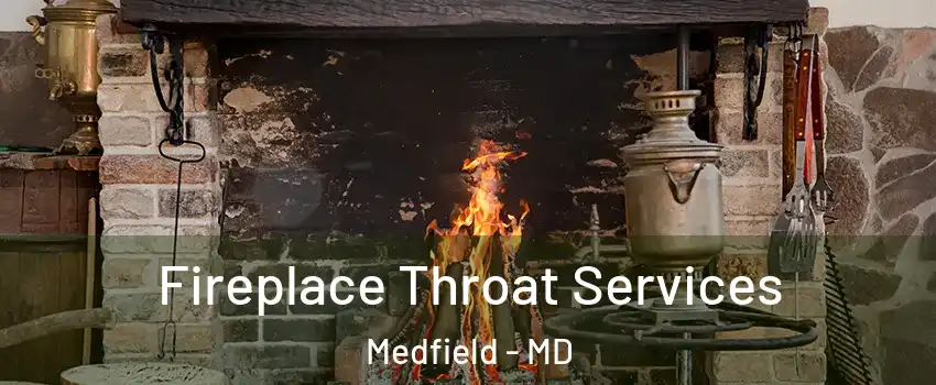 Fireplace Throat Services Medfield - MD